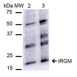 IRGM Antibody, Novus Biologicals 100 &mu;g | Buy Online | Bio-Techne | Fisher Scientific